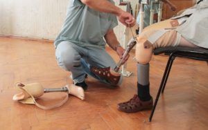 Técnico ajustando pierna ortopédica a paciente