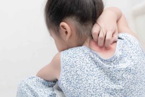Niña de espaldas rascando sarpullido detrás del cuello