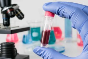 Muestra de sangre