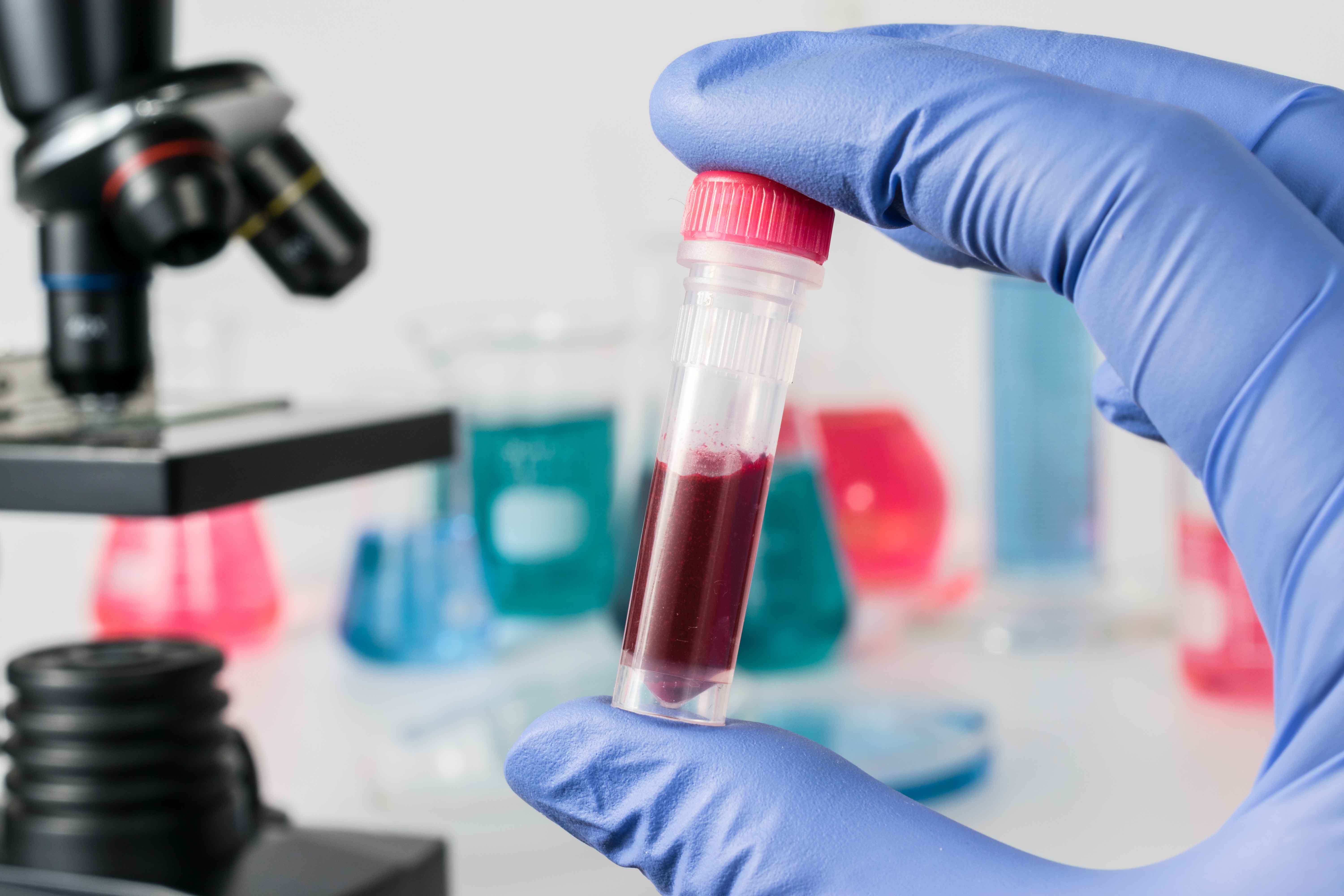 Muestra de sangre
