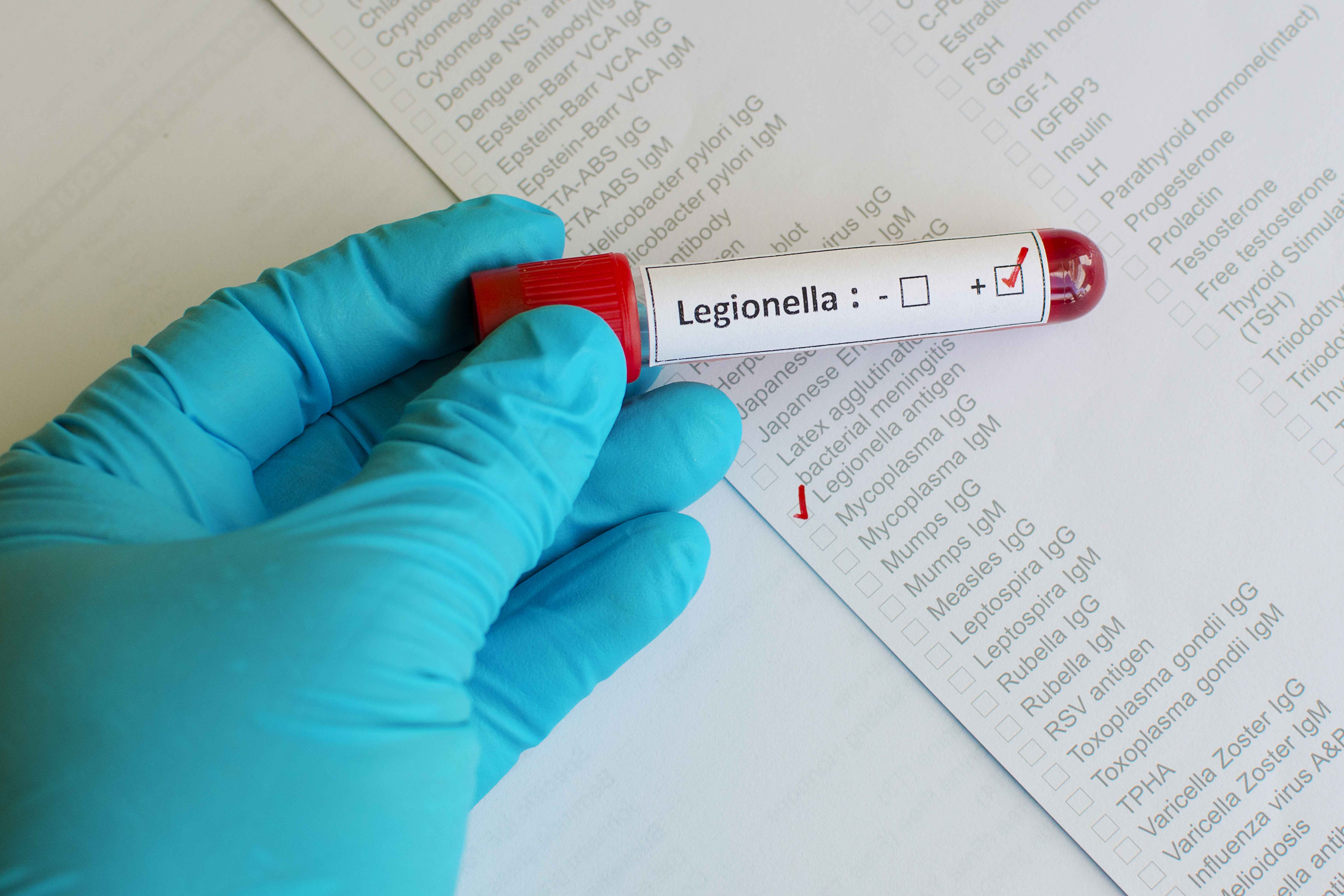 Muestra de sangre con etiqueta "legionela"