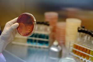 Cristal de laboratorio con muestras biológicas