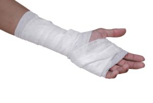 Mano vendada